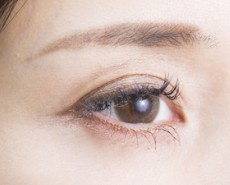 眼瞼下垂・眼瞼挙筋前転法（自由診療）
