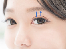 眼瞼下垂術(挙筋腱膜前転法／埋没法):目元をより大きく魅せる
