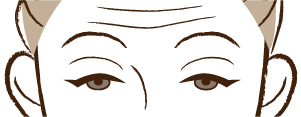 眼瞼下垂の特徴