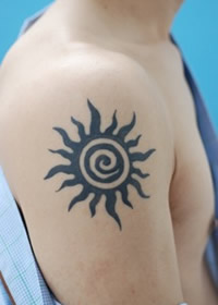 「削皮術（炭酸ガスレーザー）による刺青除去」の症例写真・ビフォーアフター