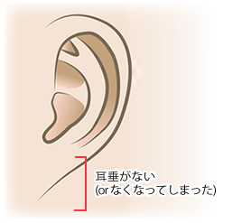 耳たぶに膨らみがない直線的な形状