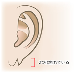 耳たぶに膨らみがない直線的な形状