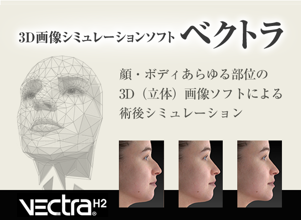3D画像シミュレーションソフト「ベクトラ」