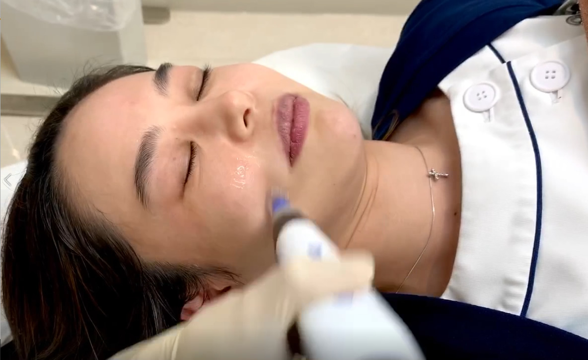 ダーマペン4 美白 美肌 スキンケア 美容皮膚科 池袋の美容皮膚科 美容外科なら みずほクリニック
