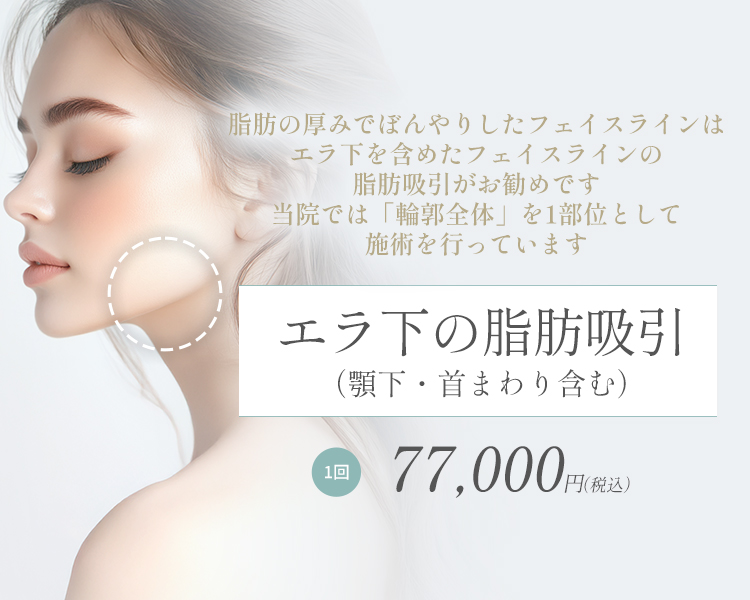エラ下の脂肪吸引（顎下・首まわり含む）