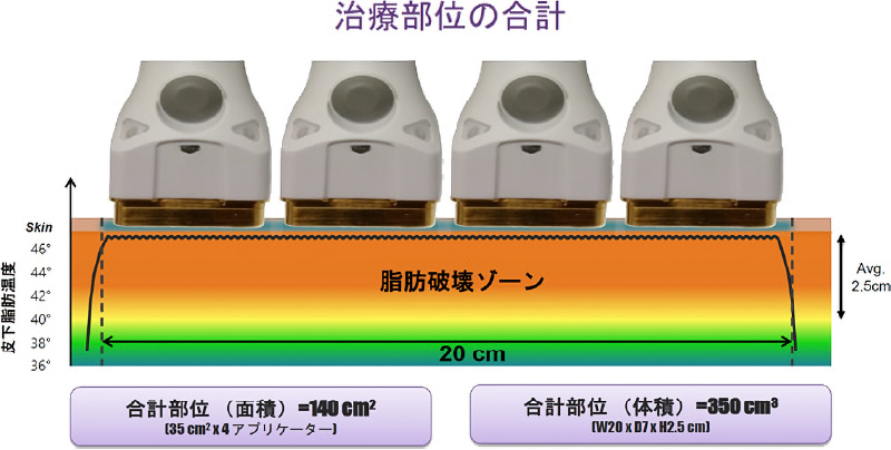 治療部位の合計