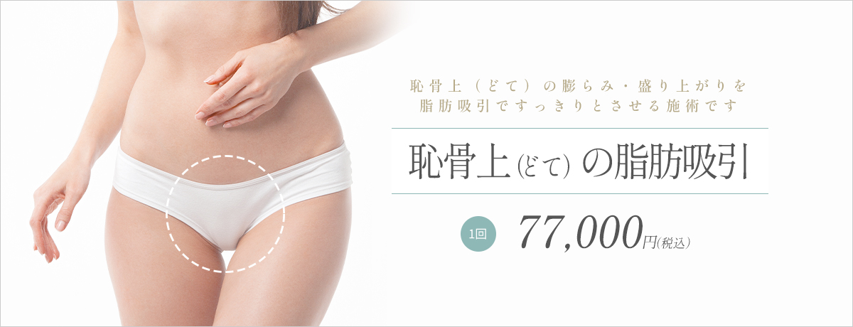 恥骨上(どて)の脂肪吸引