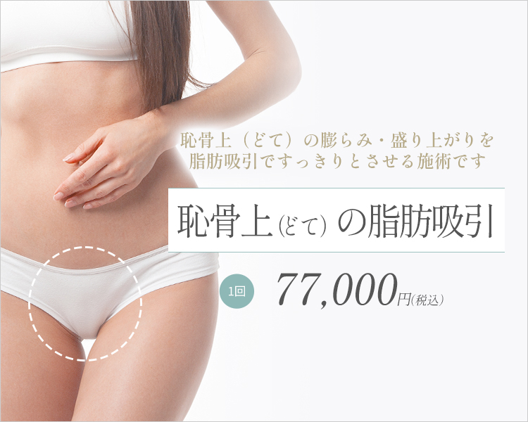 恥骨上(どて)の脂肪吸引
