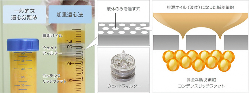 しこりのない、より自然で柔らかいバストに