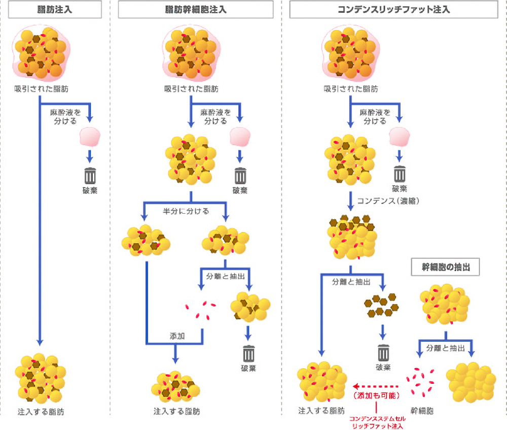 コンデンスリッチファット