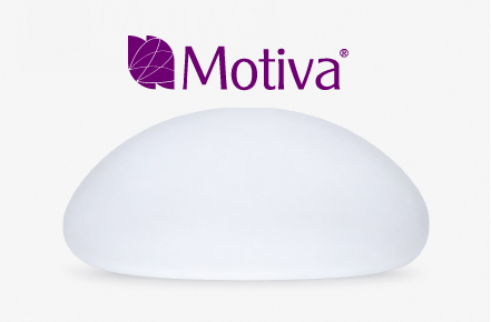 モティバ(Motiva)とは