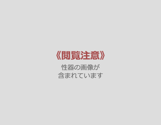 包茎症例（真性包茎）