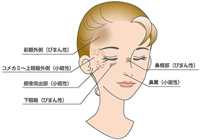 ADMの特徴