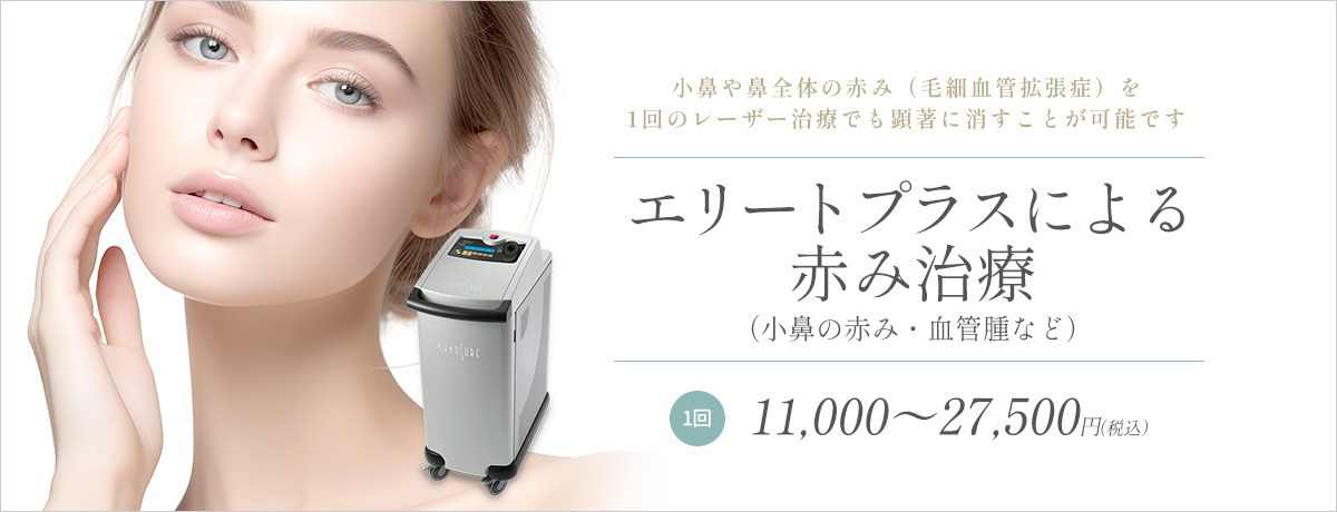 エリートプラスによる赤み治療(小鼻の赤み・血管腫など)