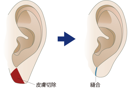 「耳の下半分」(耳垂/じすい)が大きい