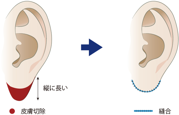 縦方向に縮める