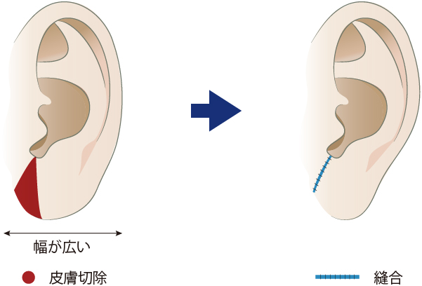 横方向に縮める