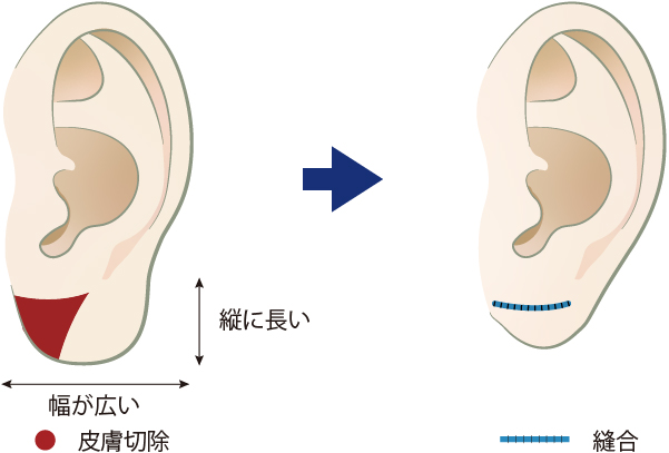 縦+横方向に縮める