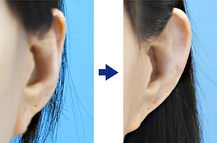 そもそも「立ち耳」の定義とは?