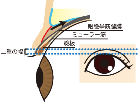 二重まぶたの構造