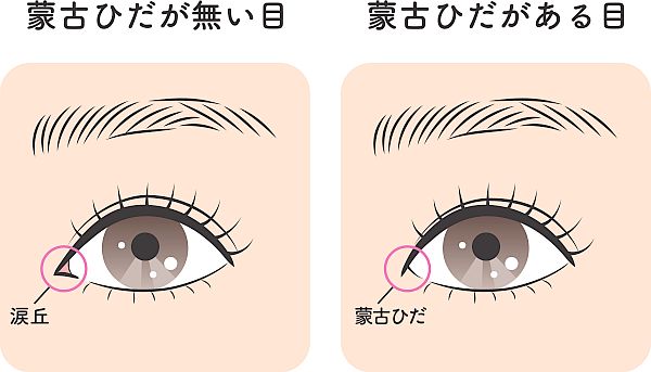 蒙古襞の有無による印象の違い