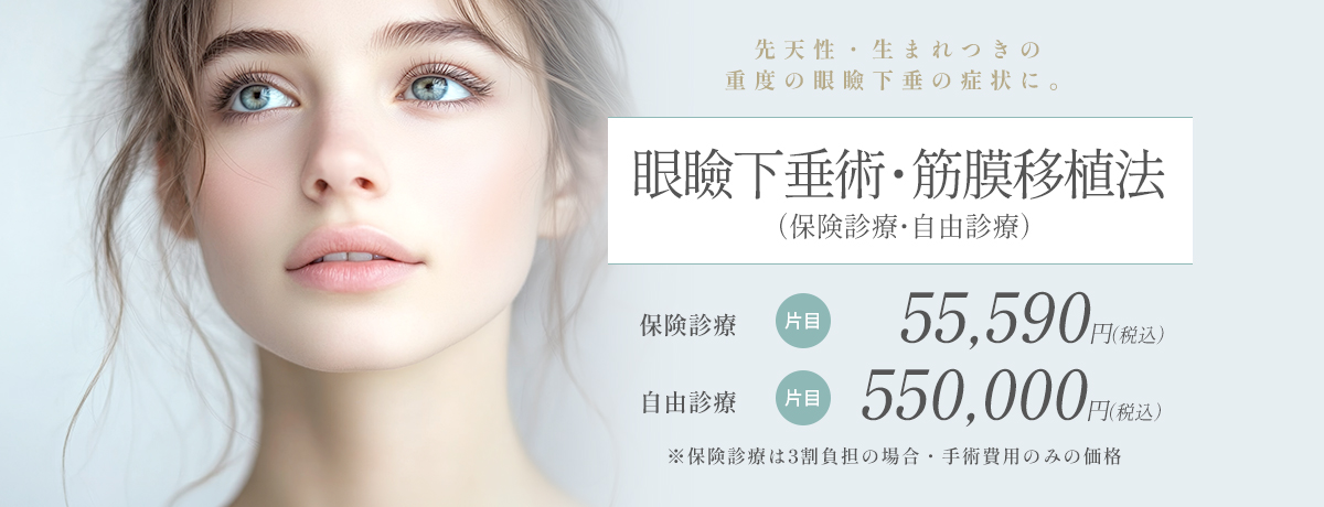 眼瞼下垂症手術・筋膜移植術(保険診療or自由診療)