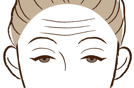 眼瞼下垂の特徴