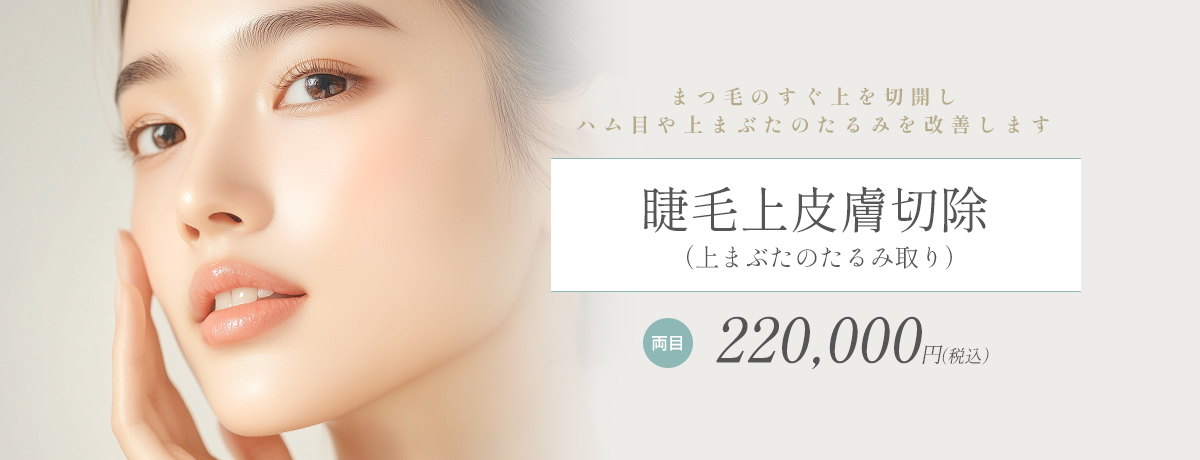 睫毛上皮膚切除（上まぶたのたるみ取り）