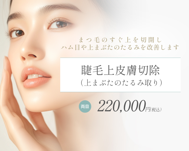 睫毛上皮膚切除（上まぶたのたるみ取り）