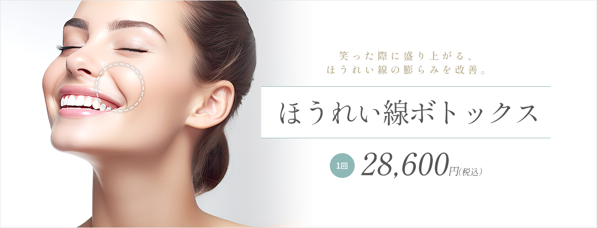 ほうれい線ボトックス