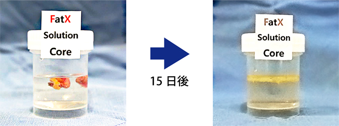 脂肪溶解×脂肪除去によるダブル痩身効果