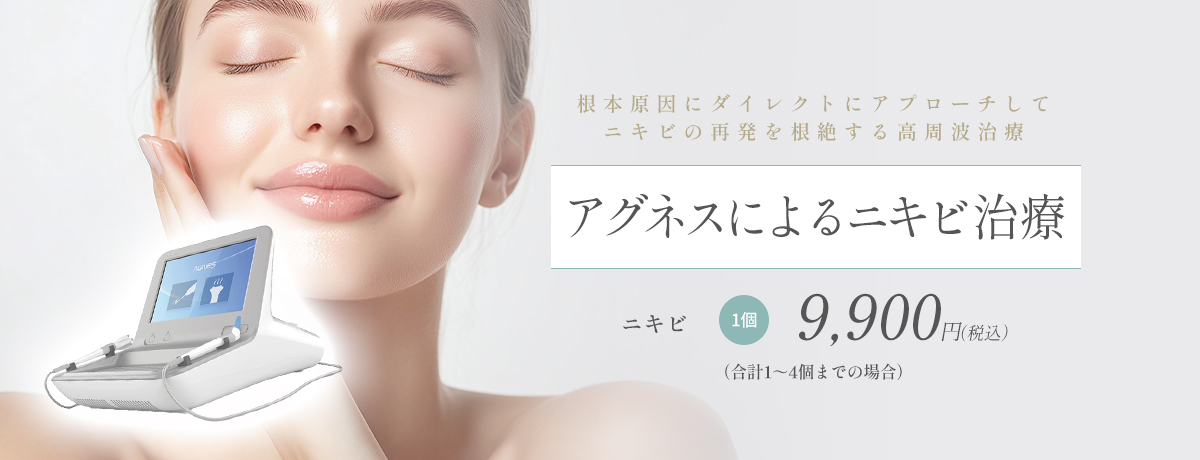 アグネス（高周波）によるニキビ治療