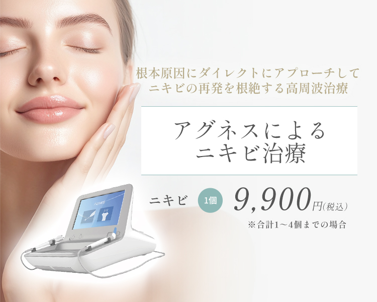 アグネス（高周波）によるニキビ治療