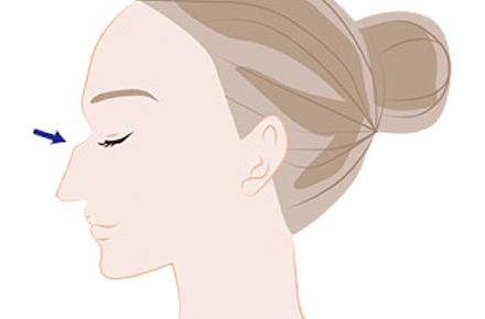 鼻の高さや鼻筋の太さを整える