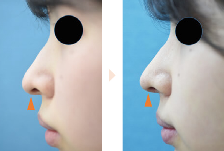 下垂した鼻先を上に向ける