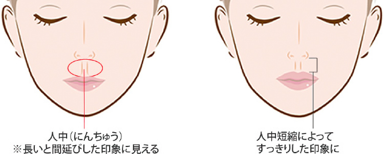 人中の黄金比は「1:2」、理想的な長さは人差し指1本分