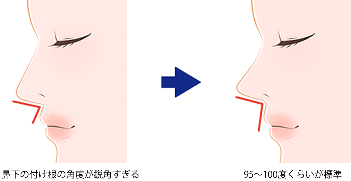95~100度くらいが標準