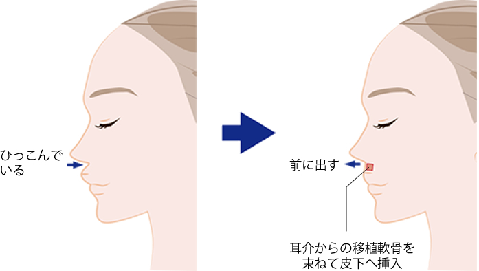 ひっこんでいる