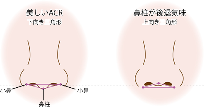 ARC