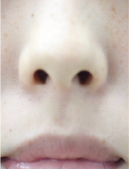 鼻先が上を向いている