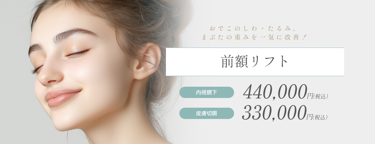 前額リフト