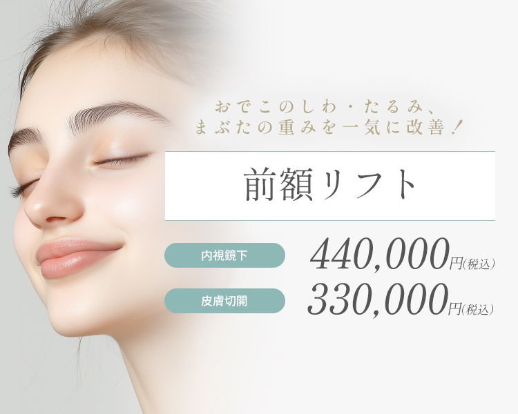 前額リフト
