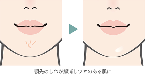 顎先のしわが解消しツヤのある肌に