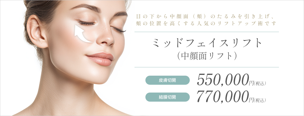ミッドフェイスリフト（中顔面リフト）