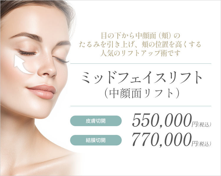ミッドフェイスリフト（中顔面リフト）