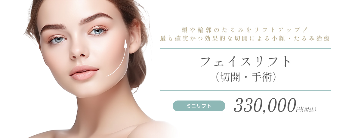 フェイスリフト