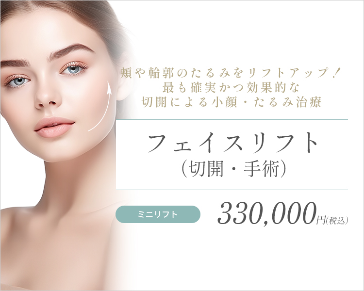 フェイスリフト