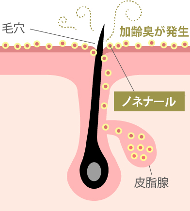 加齢臭治療について
