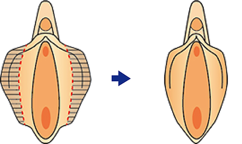 大きさやサイズ調整が可能部位について