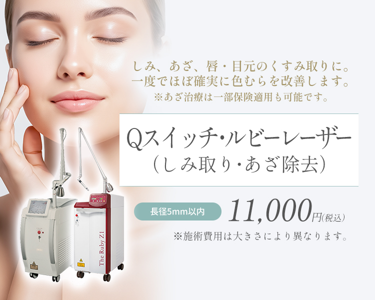 Qスイッチ・ルビーレーザー（しみ取り・あざ除去）